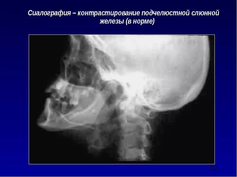 Сиалодохит
