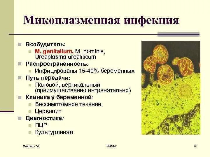 Микоплазма зев. Микоплазмы - возбудители заболеваний дыхательных путей. Микоплазменная инфекция возбудитель. Микоплазмы источник инфекции. Микоплазменная инфекция у детей возбудитель.