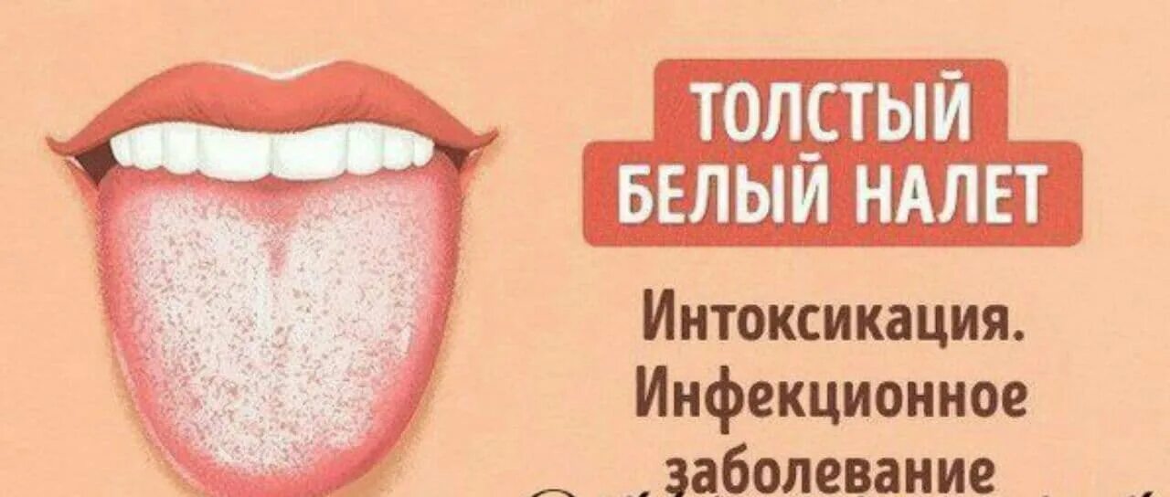 Язык человека литературный. Заболевания по цвету языка.