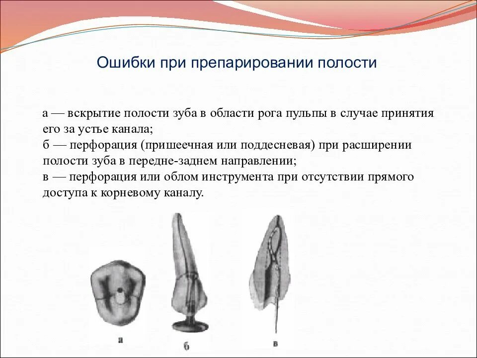 Метод вскрытия и раскрытия полости зуба. Полость ошибка. Повреждение бором смежных зубов и десневого края. Этап вскрытия кариозной полости. Туннельный метод препарирования зубов.