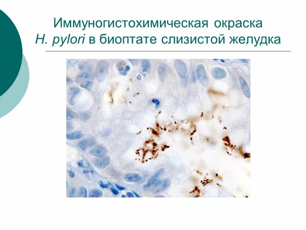 Биоптат слизистой оболочки. Иммуногистохимия окраска. Иммуногистохимическое исследование. Иммуногистохимическое исследование хеликобактер. Иммуногистохимический метод.
