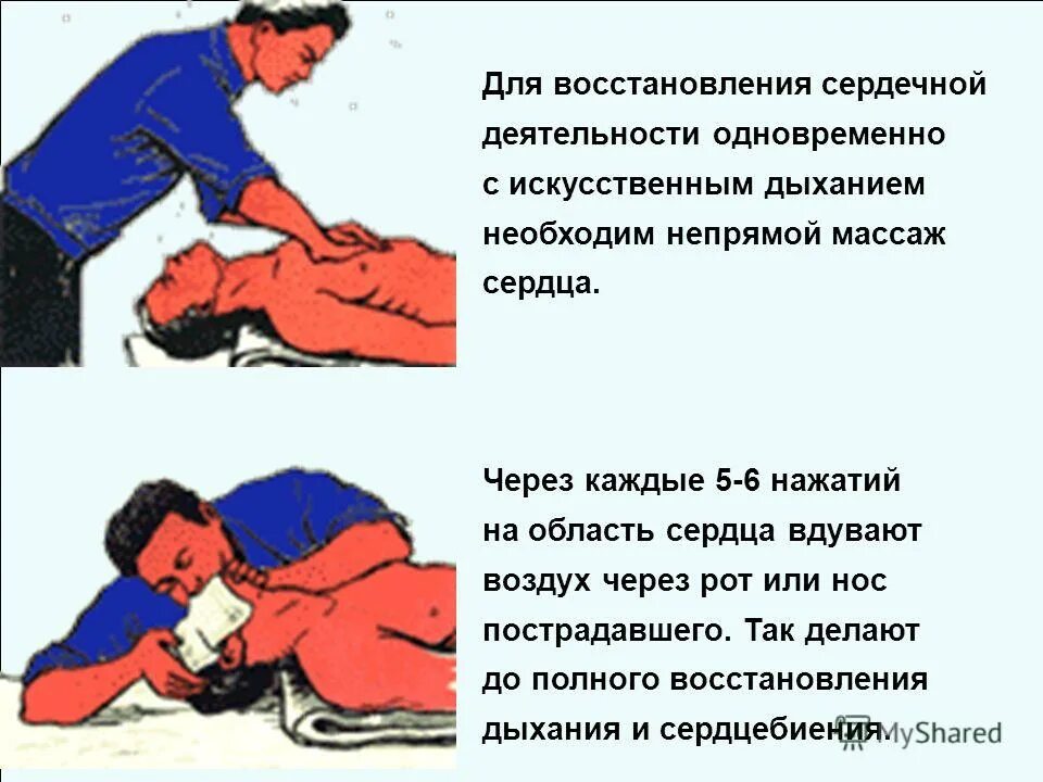 Непрямой массаж сердца осуществляется. Прекращение сердечной деятельности и дыхания у пострадавшего. при остановке дыхания и сердечной деятельности. оказание первой мед помощи непрямой массаж сердца. порядок действий при искусственном дыхании.