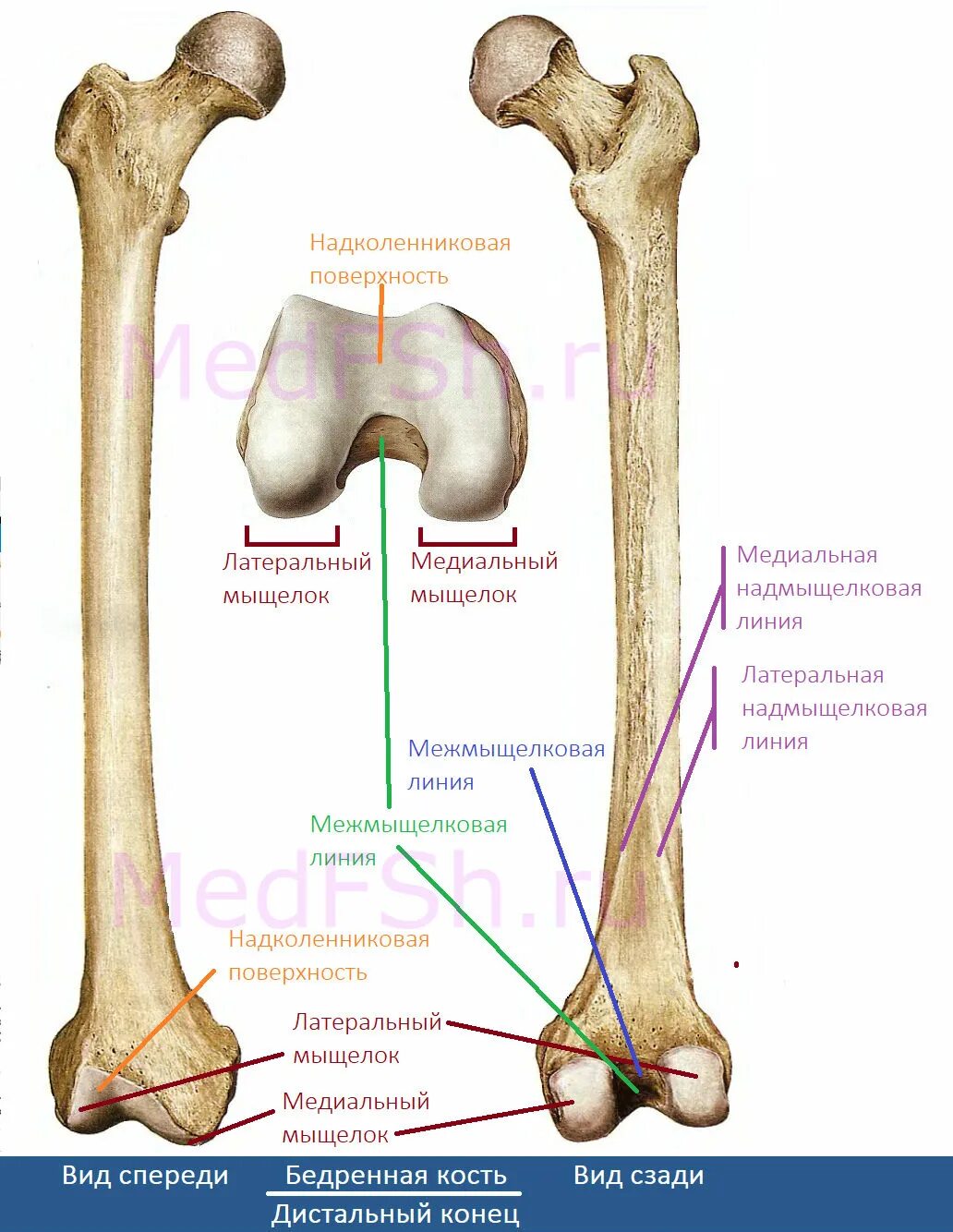 Медиальная мыщелка бедренной кости. Бедренная кость анатомия метафиз. Медиальный мыщелок бедренной кости анатомия. Латеральный мыщелок берцовой кости. Латеральный мыщелок бедренной кости.