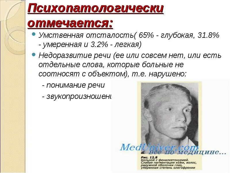 Страдающий умственной отсталостью. Умственная отсталость. Глубокая умственная отсталость. Глубокая умственная отсталость (идиотия).. Глубокая степень умственной отсталости.