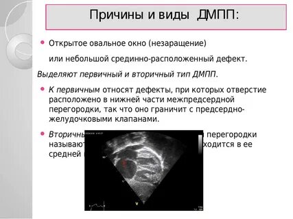 Овальное окошко у детей