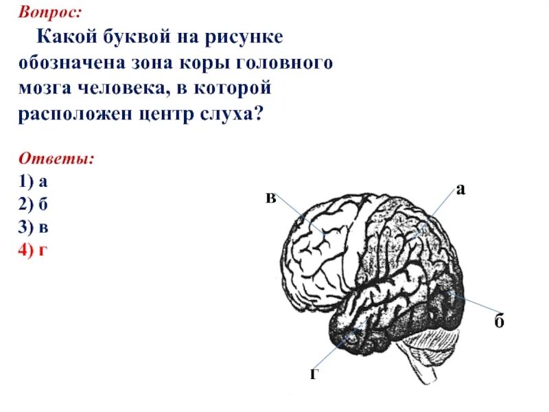 В какой доле слуховая зона. Кость защищающая слуховую зону коры головного мозга. Клмть зпщтщающач слуховую зону коры головного мозга. Какие зоны обозначены на рисунке.