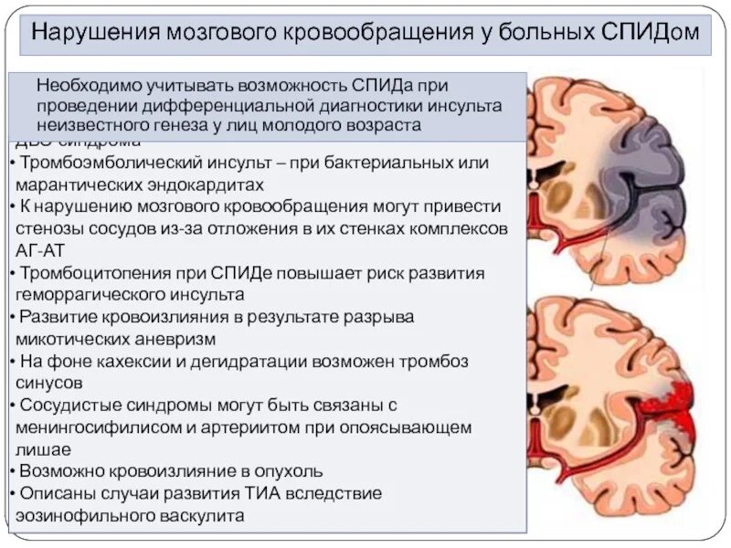 Нарушение мозгового кровообращения. При нарушении кровообращения мозга. Кровоснабжение мозга при энцефалопатии.