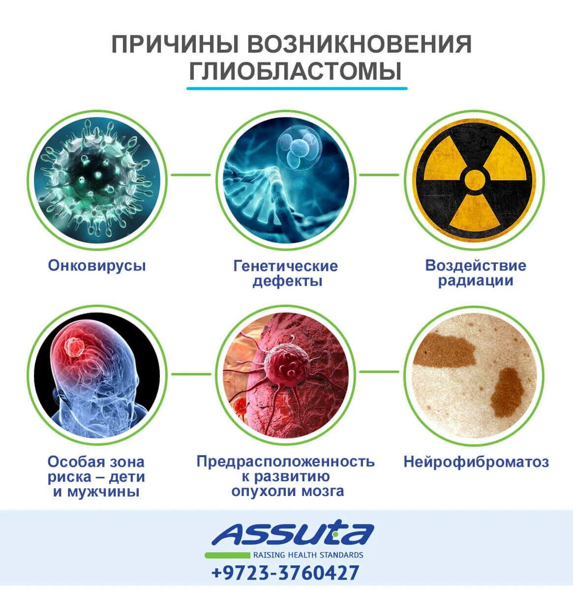 Признаки опухоли головного мозга на ранних стадиях. Клинические проявления опухоли головного мозга. Опухоль мозга симптомы на ранней стадии. Опухоль головного мозга первые симптомы. Опухоль головного мозга симптомы на ранних стадиях.