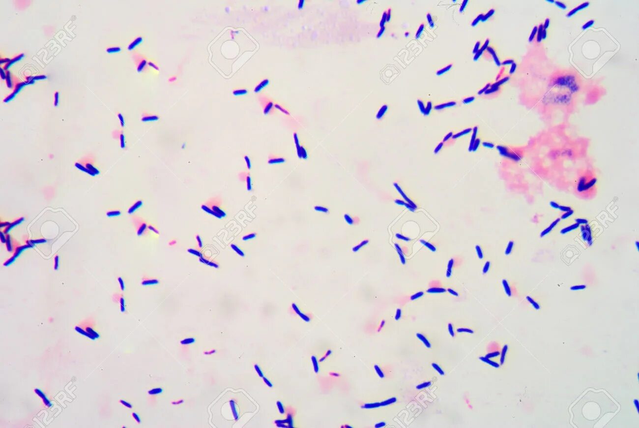 Bacillus subtilis споры. Грамположительные палочки. Коринебактерии.. Грамположительные палочковидные бактерии. Лактобациллы грамположительные. Lactobacillus spp у мужчин