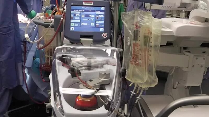 Селл сейвер 5+. Аппарат для аутотрансфузии крови селл сейвер 5. Реинфузия крови cell saver. Селл сейвер аппарат для трансфузии. Cell saver 5 аппарат для реинфузии крови.