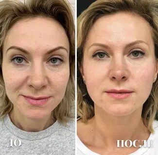 Монако для лица отзывы