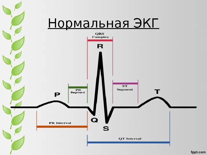 На графике изображена электрокардиограмма