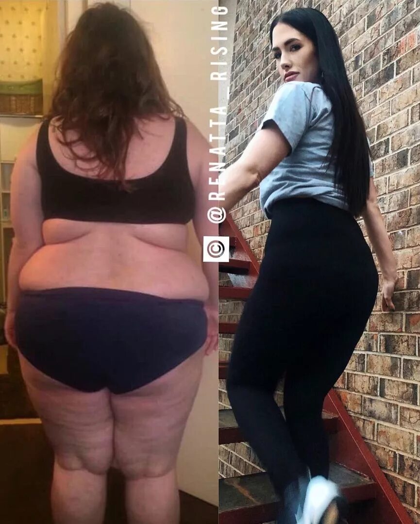 Крупная кость у девушки. Толстые девушки 16 лет. Девушка 64 кг. 130 кг девушка. 130 кг девушка.