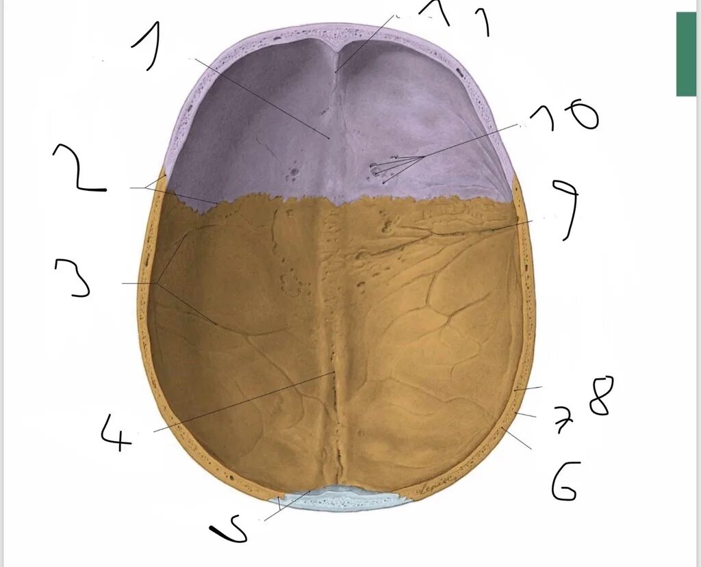 Sulcus sinus латынь. Calvaria анатомия. sulcus sinus sagittalis. lamina анатомия. foveolae granulares лобной кости.