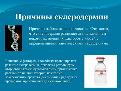 Народное лечение склеродермии