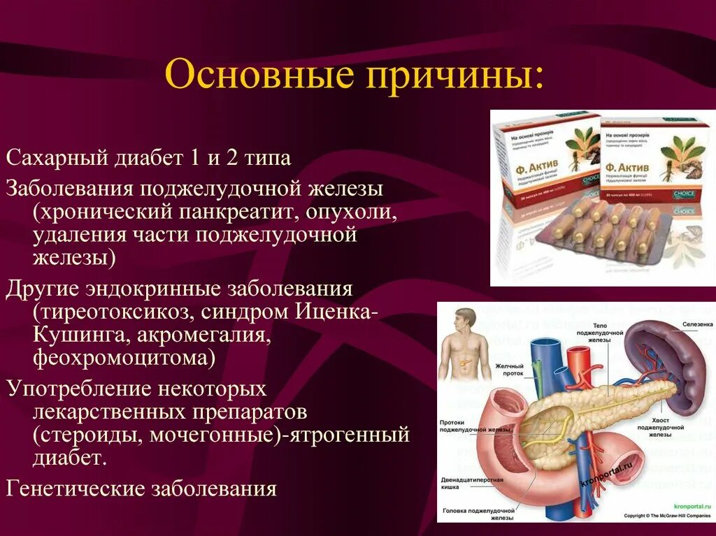 Сахарный диабет относится к заболеваниям. Причины сахарного диабета. Причинысахаоного диабета. Заболевания поджелудочной железы сахарный диабет. Сахарный диабет первого типа причины.