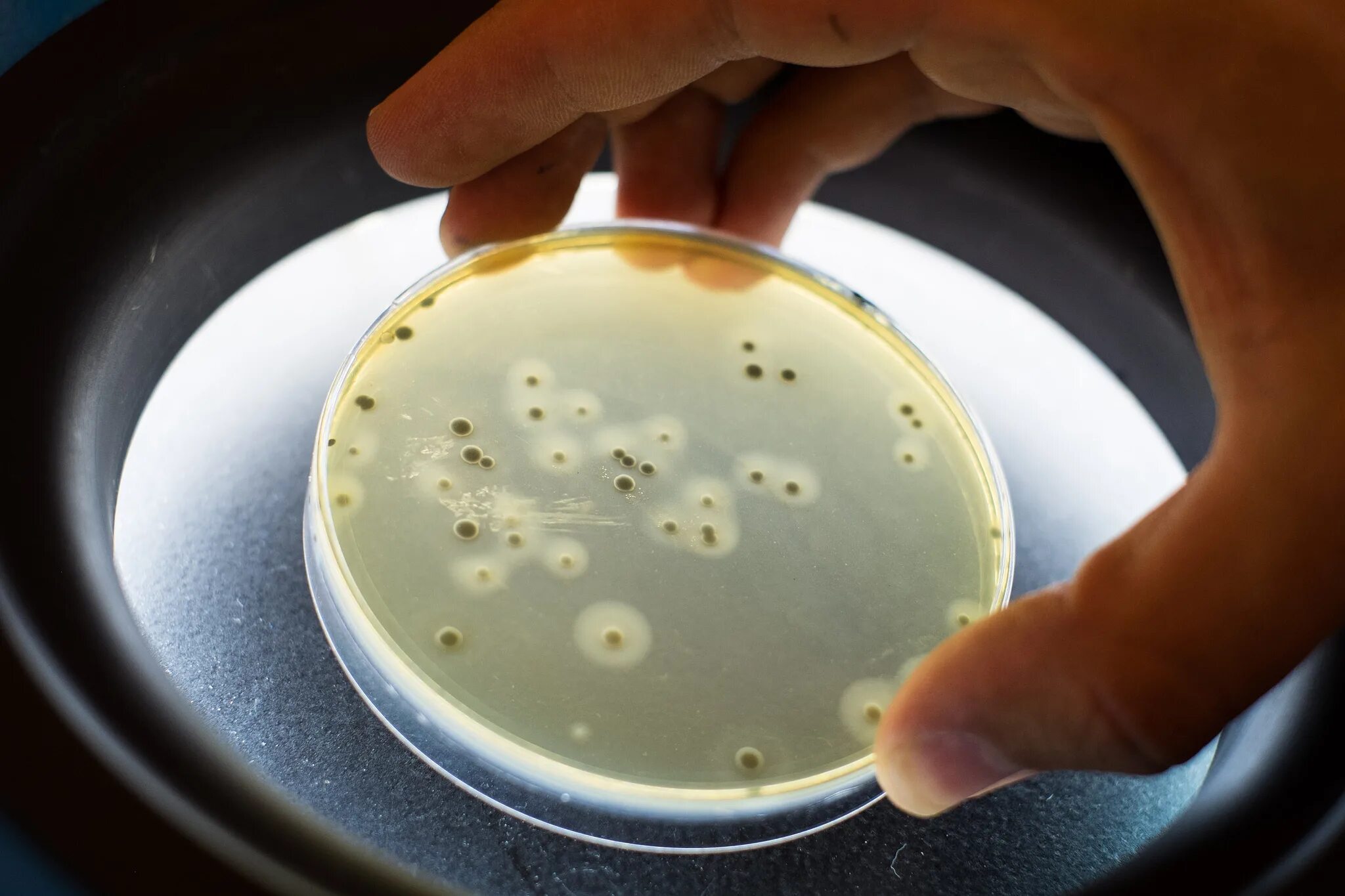 Посев staphylococcus aureus. Золотистый стафилококк на чашке петри. стафилококк в чашке петри. стафилококк ауреус петри. посев на золотистый стафилококк.