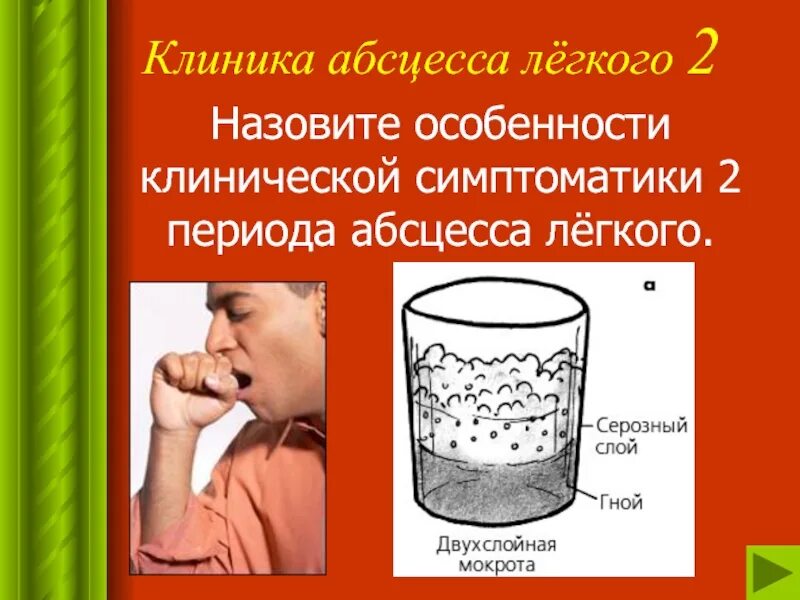 Абсцесс лёгкого мокрота. Сестринские вмешательства при абсцессе легкого. Мокрота при абсцессе лёгкого.