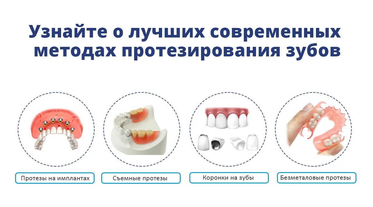 Зубные импланты верхняя челюсть протезы