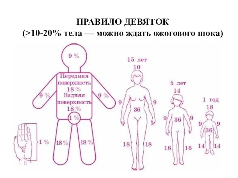 Площадь поражения при ожогах. Метод определения площади ожога правило ладони. Определение площади ожогов правило девяток. Правило девятки при определении площади ожога. Определение площади ожога правило ладони и правило девяток.