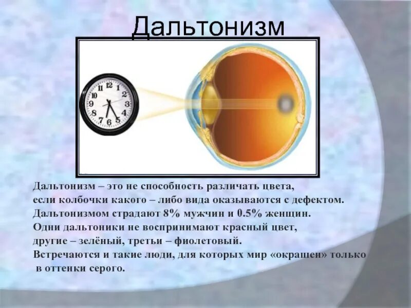 Дальтонизм. Строение глаза при дальтонизме. Дефекты цветового зрения. Строение глаза дальтоника.