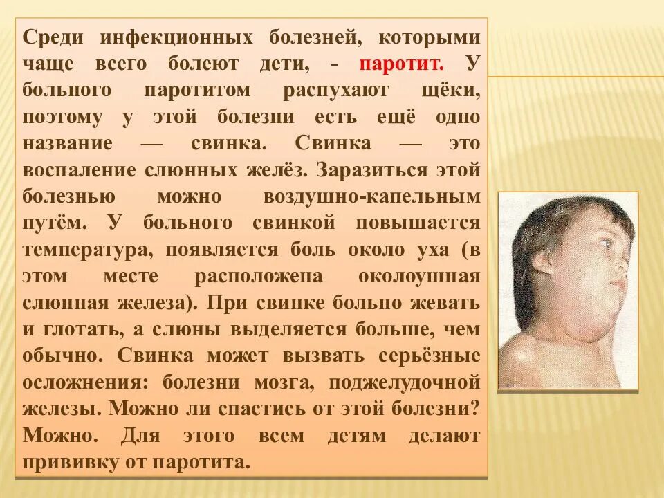 Как лечить свинку