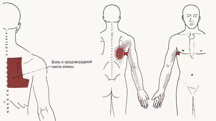 Болит под правой лопаткой у мужчины. Ноющая боль сбоку под левой лопаткой.