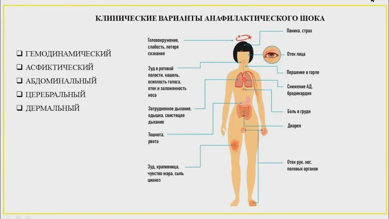 Как вводить адреналин при анафилактическом шоке. Лекарственный анафилактический шок. введение адреналина при анафилактическом шоке. куда колоть адреналин при анафилактическом шоке.