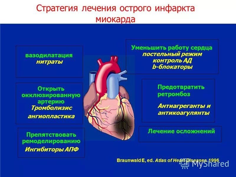 Острая сердечная коронарная недостаточность. Основные принципы терапии острого инфаркта миокарда.. ИБС инфаркт миокарда клиника. Главный признак инфаркта миокарда. Острый инфаркт миокарда сердце.