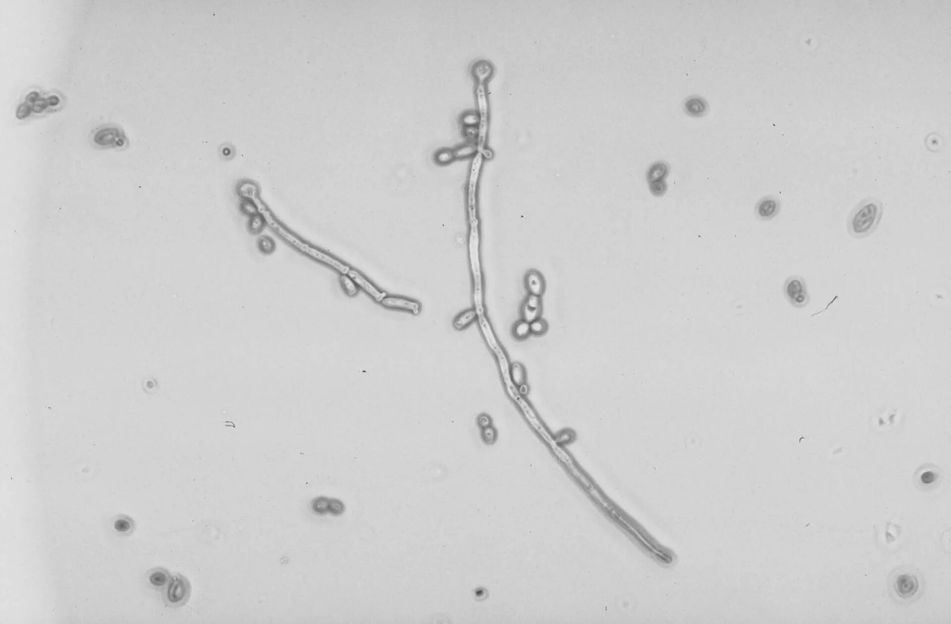 Дрожжевые грибы в анализе кала. Микроскопия кала дрожжевые грибки. Анализ кала- дрожжевые грибы- 2. Дрожжевые грибы в кале характеристика. Грибы рода кандида в кале у ребенка.