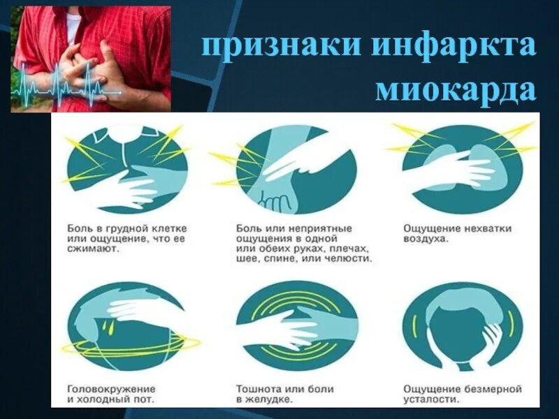 Признаки сердечного приступа у женщин после 40. Инфаркт симптомы. инфаркт миокарда симптомы. инфаркт миокарда симптомы у женщин первые. симптомы инфаркта биокад.