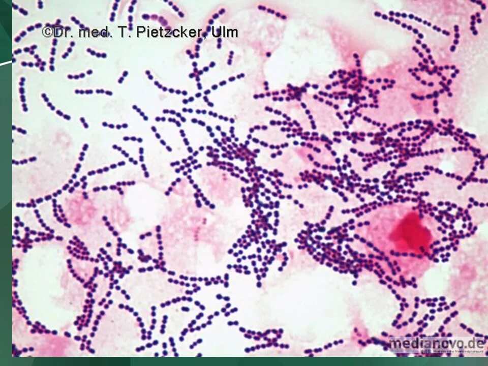 Staphylococcus в мазке у женщин