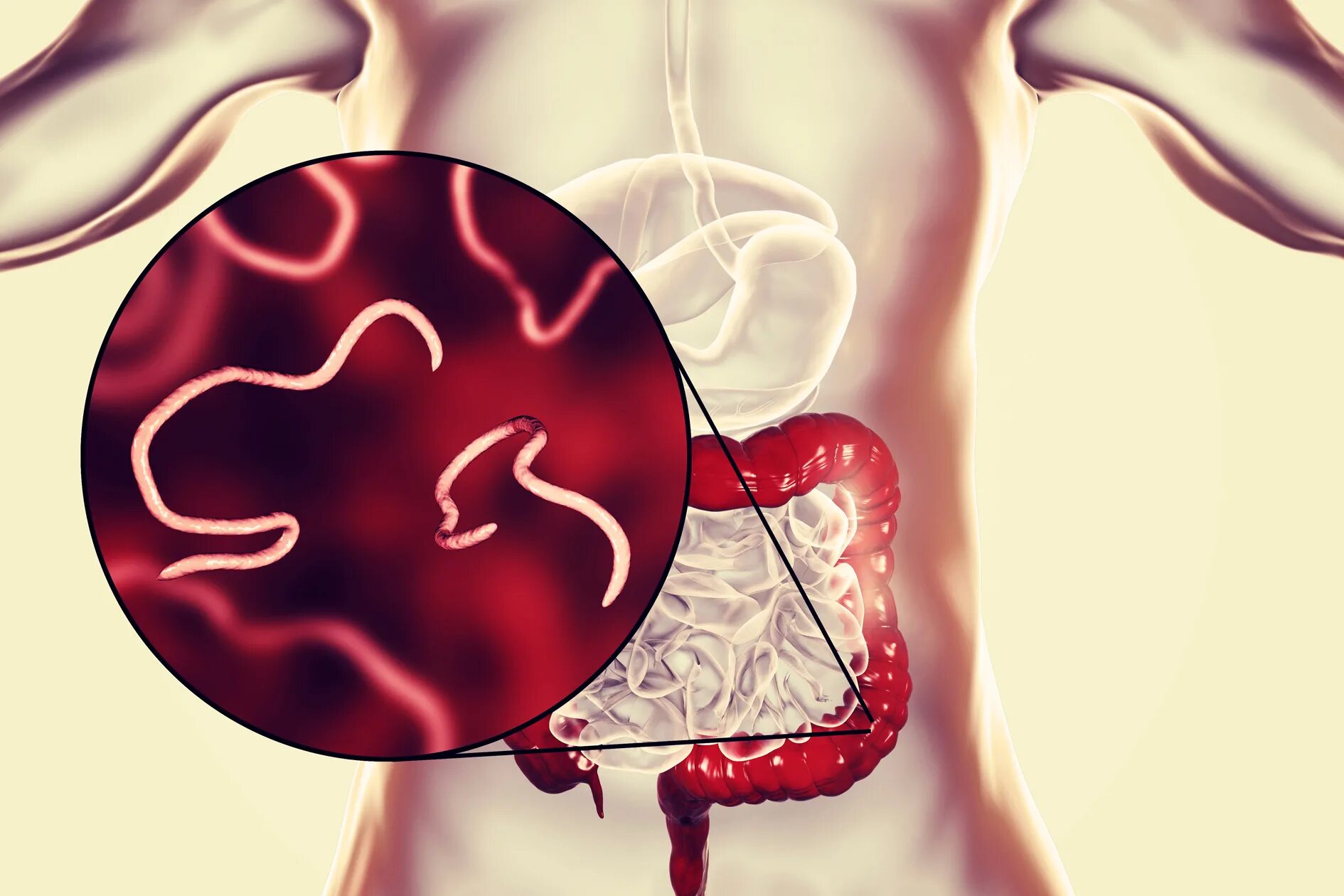 Признаки червей в организме человека. Паразиты в организме человека. Паразитарные заболевания пищеварительной системы.