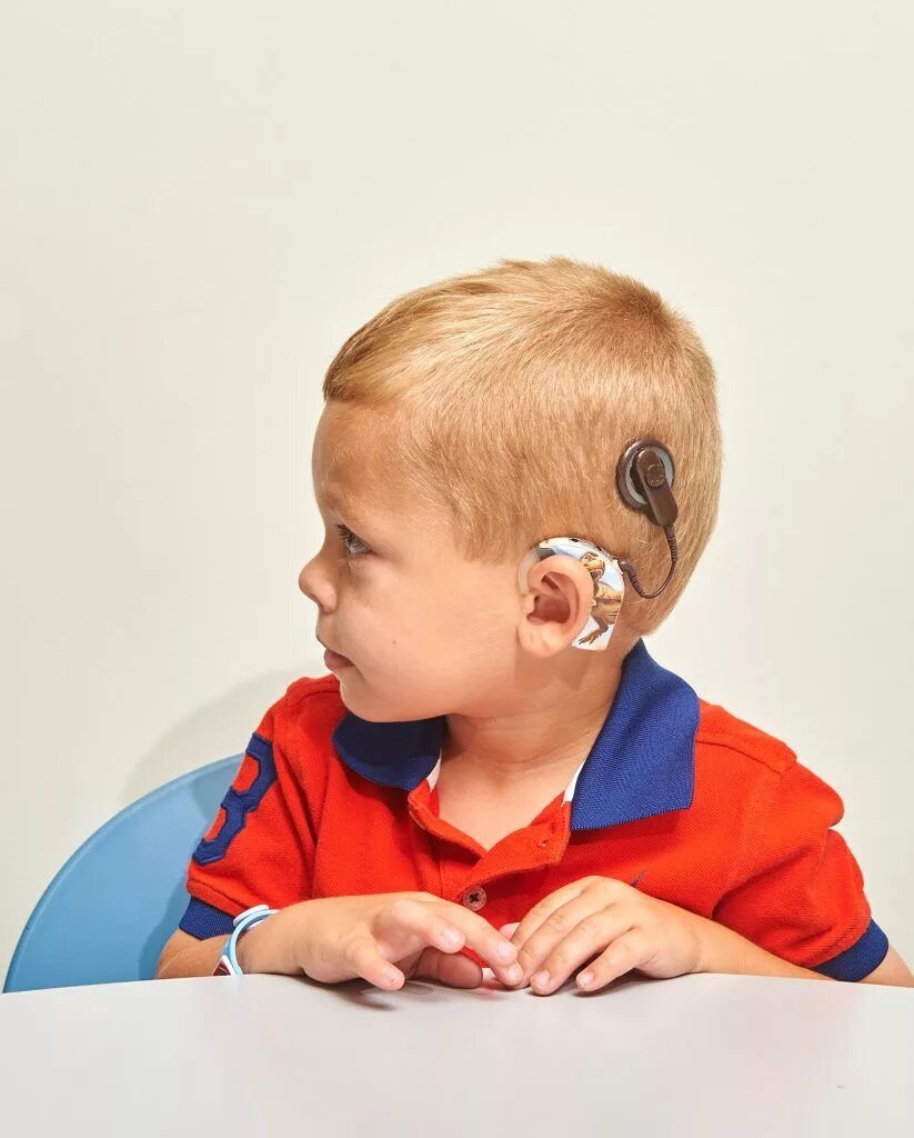 Слабослышащий ученик. Кохлеарная имплантация Cochlear. Кохлеарный имплант Кохлер. Дети с нарушением слуха.. Слуховой аппарат для детей.