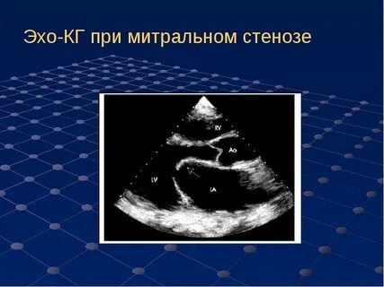 Эхо кг в туле