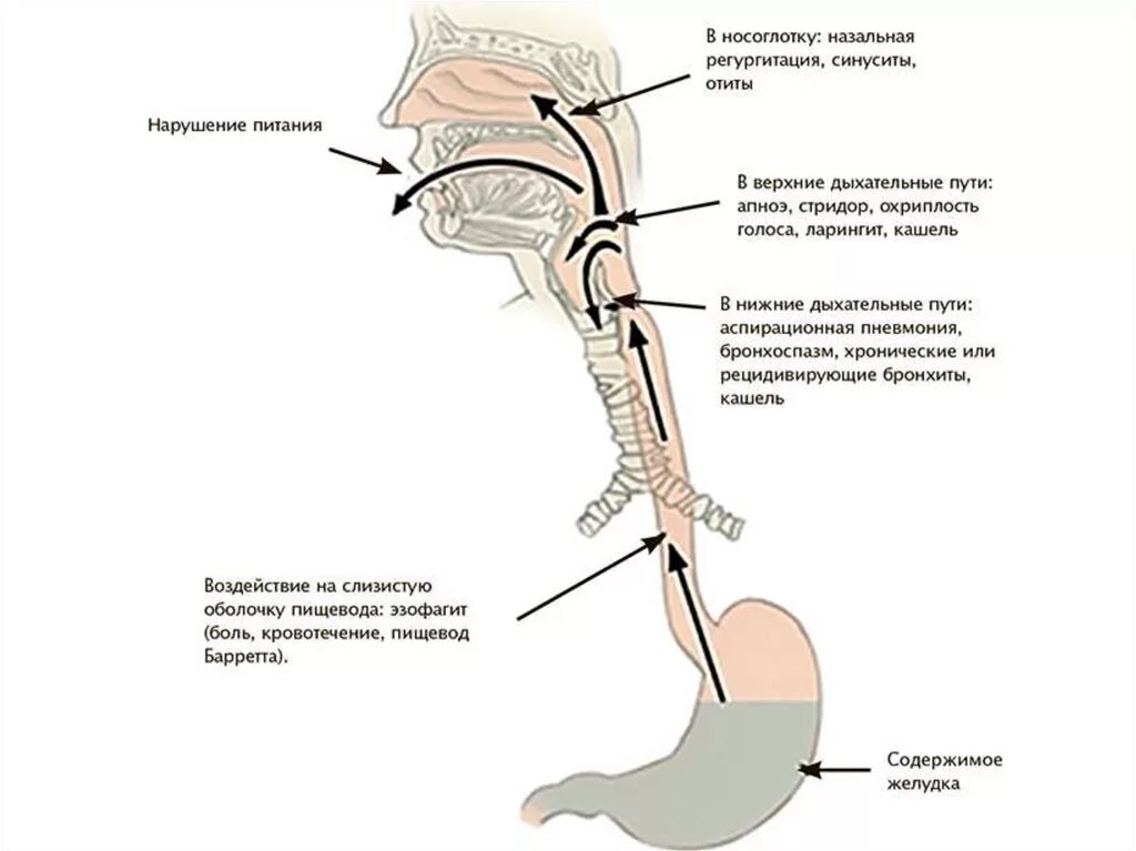 Поднимается пищевод