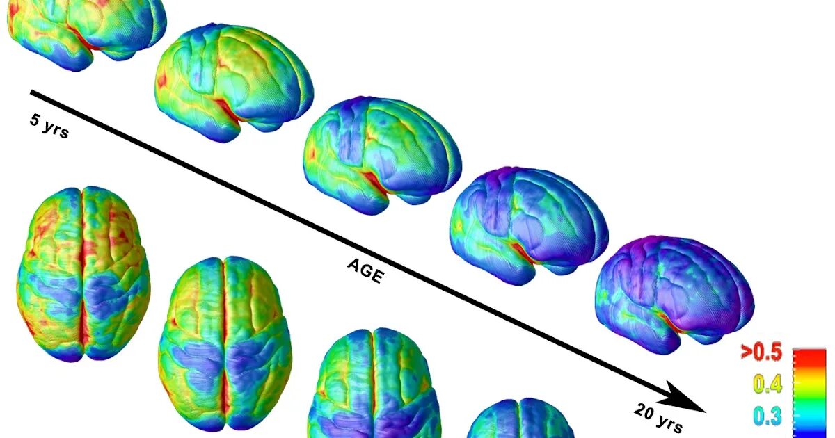 Секреты развития мозга ребенка. Созревание мозга ребёнка картинка. Three Brain Blocks. 90 % Of Childs Brain Development.