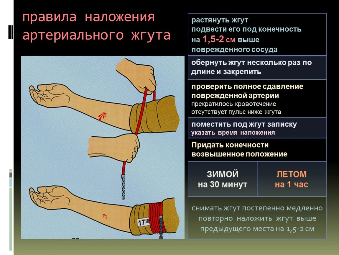 Как правильно наложить артериальный жгут. Наложение жгута на конечность. Наложение жгута на конечность при кровотечении. Наложение жгута при артериальном кровотечении из предплечья. Наложение кровоостанавливающего жгута на конечность.