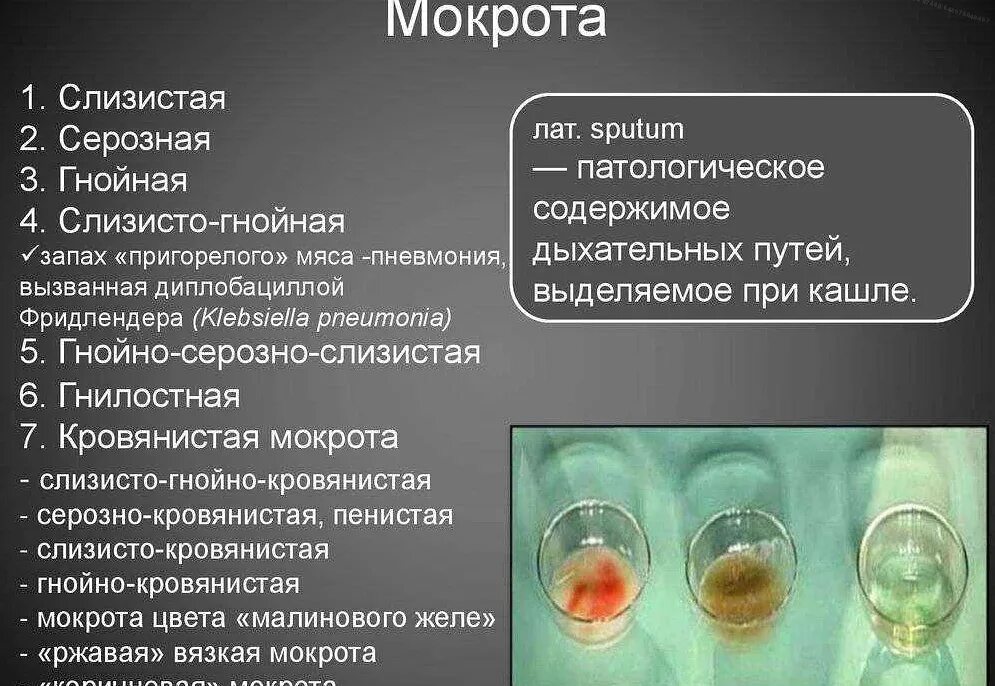 При каком кашле отходит мокрота. Гнойно слизистая мокрота. цвет мокроты и заболевания.