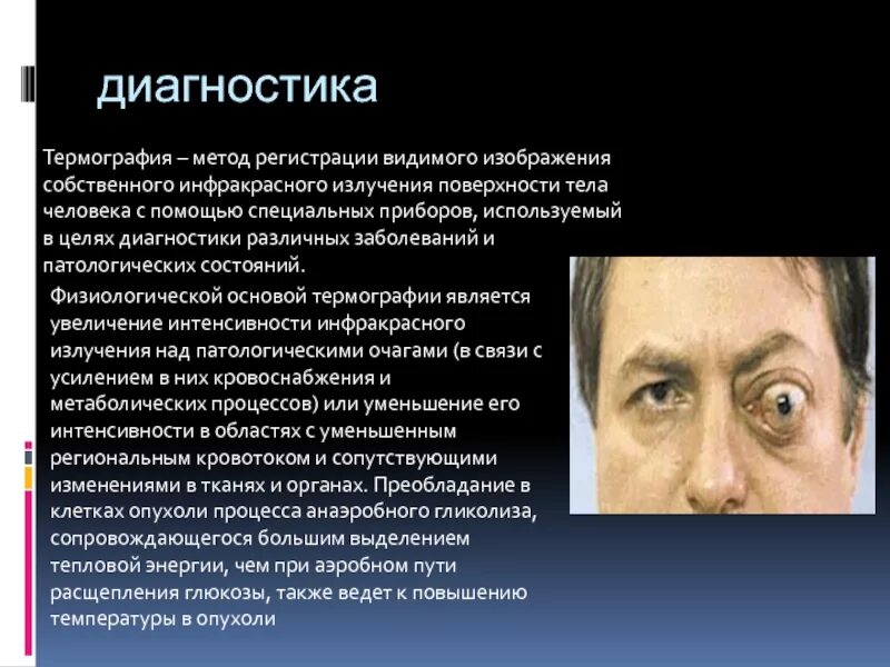 Методы диагностики опухолей орбиты. Опухоли орбиты классификация. Заболевания орбиты новообразования орбиты. Опухоли орбиты