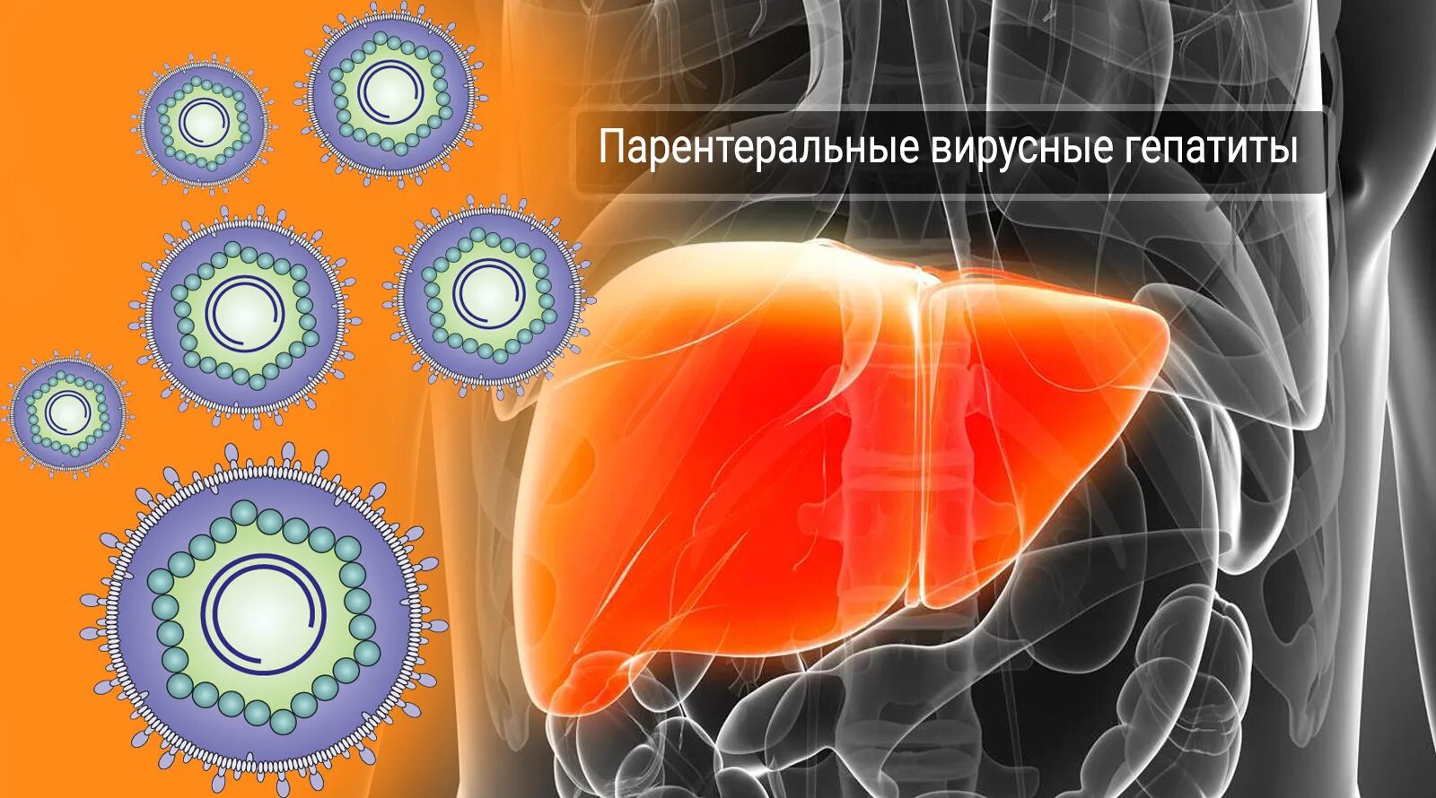 Парентеральные вирусные гепатиты. Парентеральные вирусы гепатита. Парентеральное заражение вирусными гепатитами