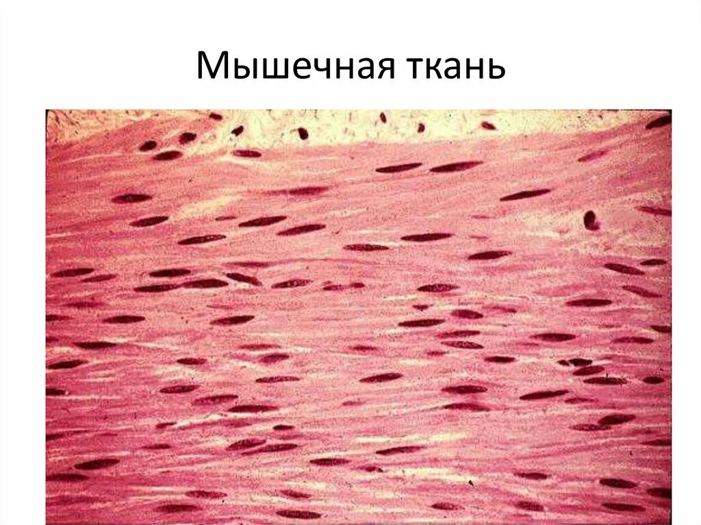 Состоят из многоядерных веретеновидных клеток. Гладкая мышечная ткань микропрепарат. Гладкая мышечная ткань гистология. Скелетная мышечная ткань микропрепарат. Гладкое мышечное волокно гистология.