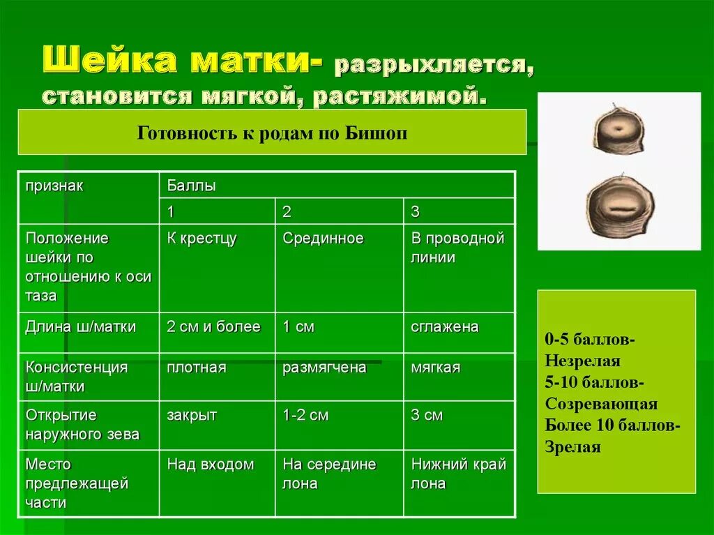 Матка 35 мм. Норма шейки матки. Показатели шейки матки нормальные. Длина шейки матки. Размеры шейки матки в норме.