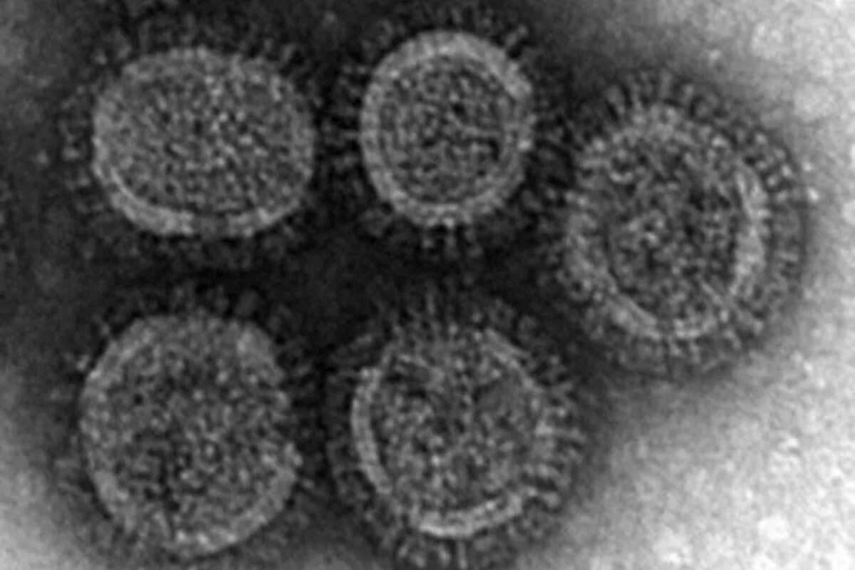 Грипп номер 1. Вирус гриппа h5n1. Вирус h1n1 испанка под микроскопом. Вирус гриппа под микроскопом h1n1.