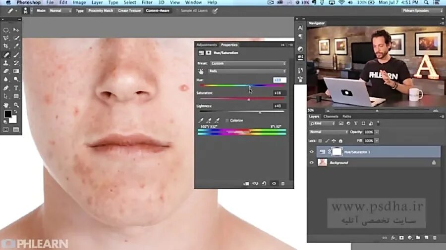 Как убрать прыщи на фото в фотошопе. Убирание прыщей в фотошопе. Крем который моментально убирает красноту на лице. Убрать красные глаза в фотошопе. Программа для убирания прыщей с фото.