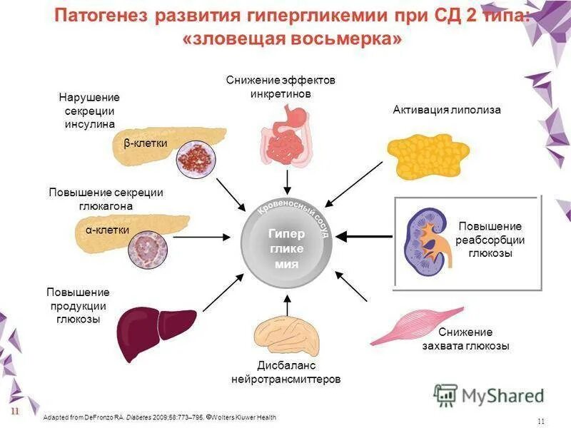 Как получить сахарный диабет 1 типа. Диабет 1 типа механизм. патогенез развития сахарного диабета. механизм развития гипергликемии при сд 2 типа. механизм формирования сахарного диабета 2 типа.