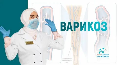 Про варикоз грушевская