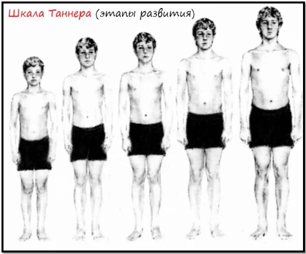 Взросление подростка мальчика. Половое созревание у мужчин. Стадии полового созревания у мальчиков. Период взросления у мальчиков.