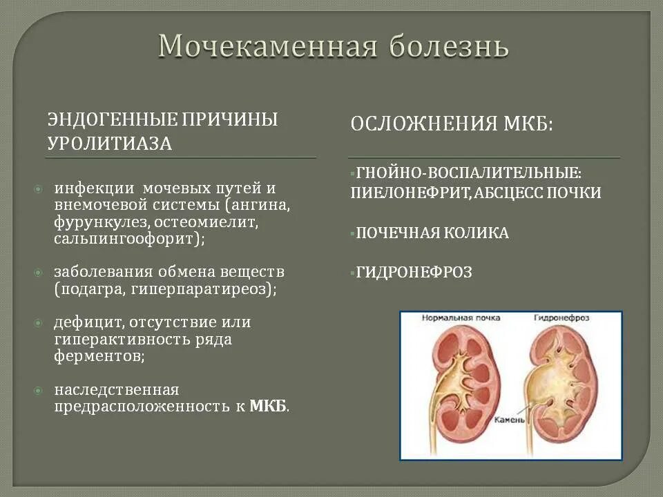 Мочекаменная болезнь причины заболевания. Мочекаменная болезнь почек классификация. Мочекаменная болезнь патанатомия. Основные клинические проявления мочекаменной болезни. Заболевания мочевыделительной системы мочекаменная болезнь.