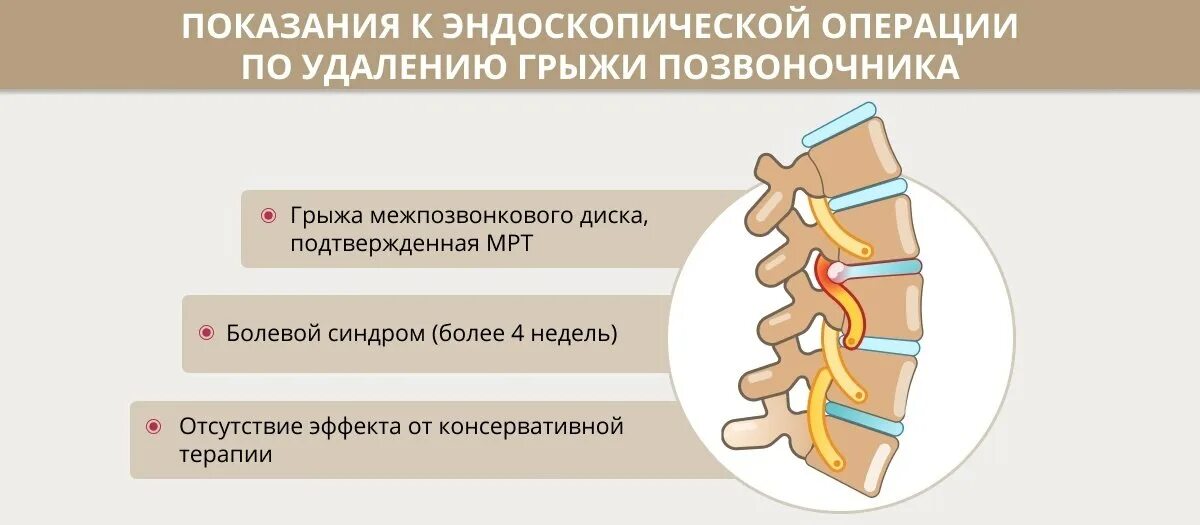 Межпозвоночная грыжа. Межпозвоночная грыжа показания к операции. Операция на диски позвоночника. Грыжа межпозвоночного диска операция. После операция грыжа диска